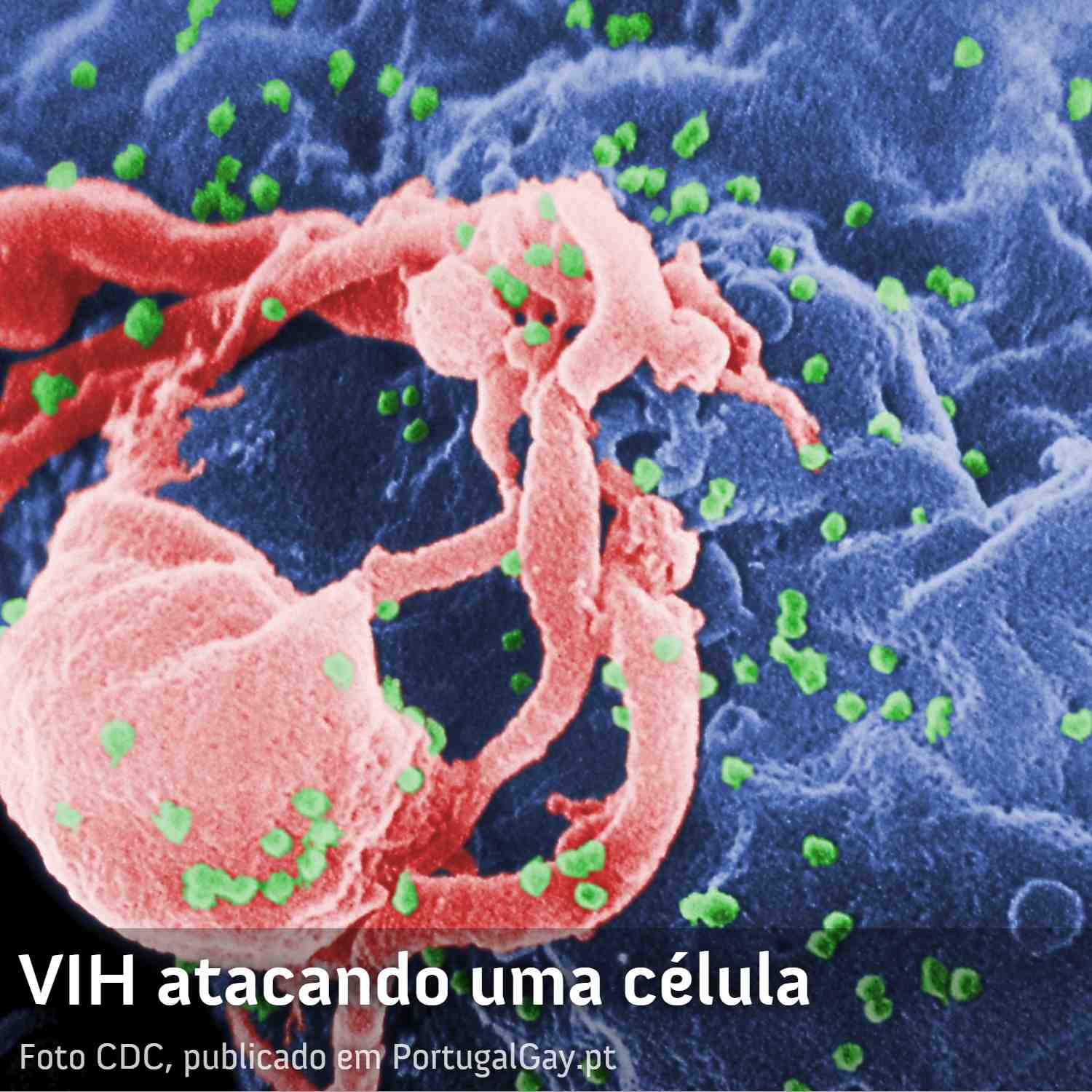 SAÚDE: Algumas pessoas VIH+ conseguem passar anos sem medicação e com o vírus controlado